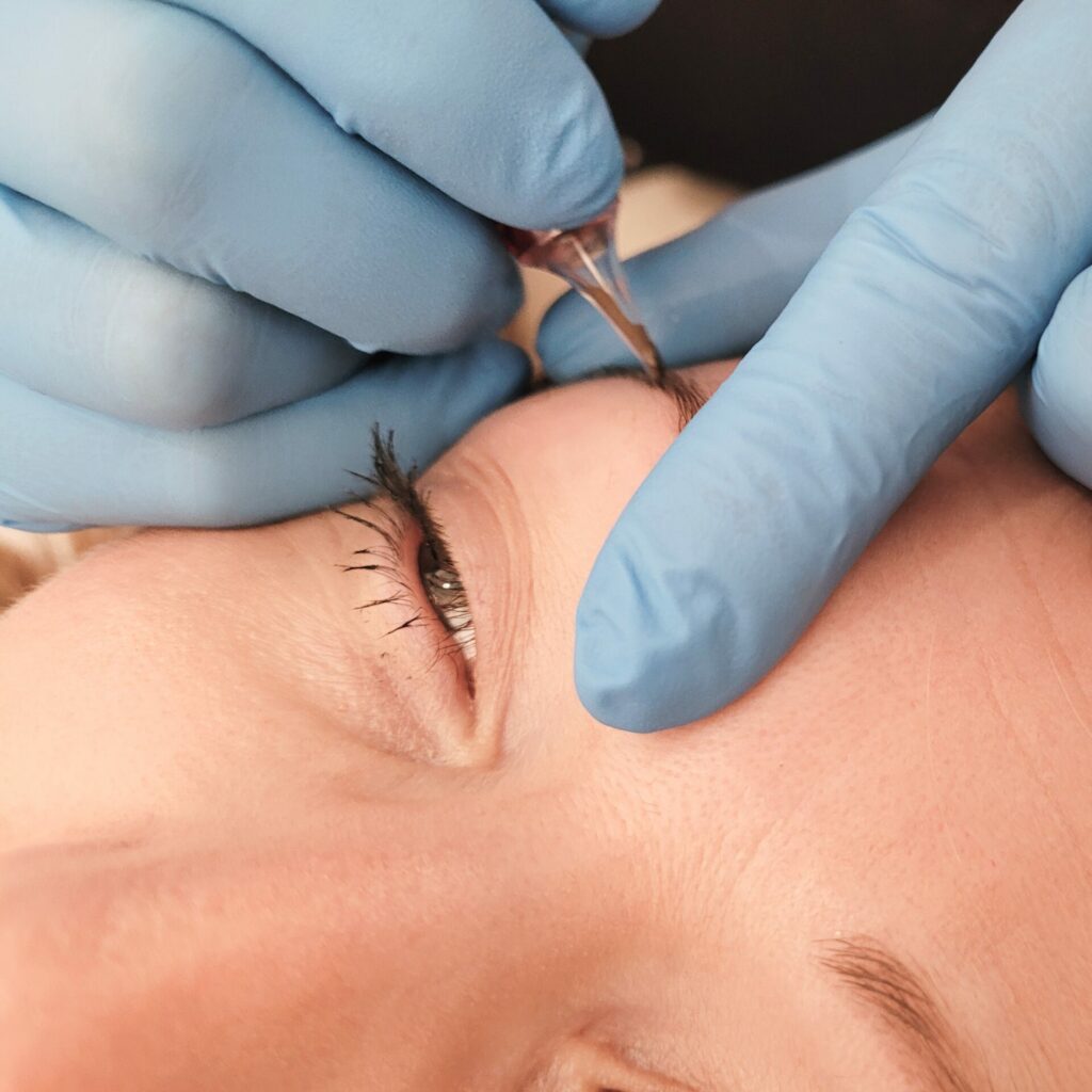 Dermopigmentation à Dijon