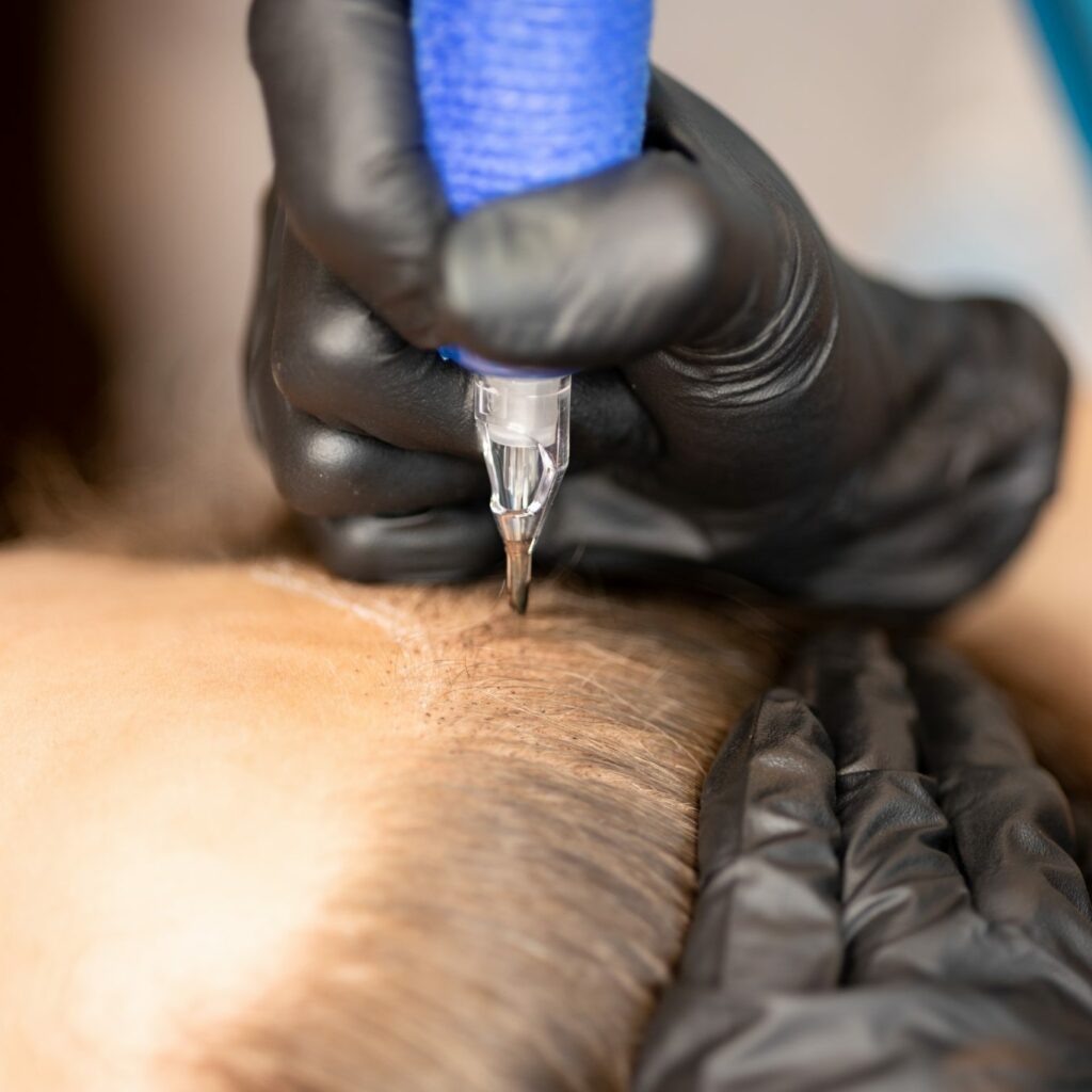 Tricopigmentation Dijon - Peau'M Marine Laligant